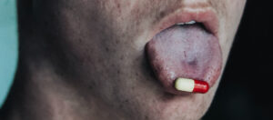 pill stuck on man's tongue graphic for article Amazon suicide suit
